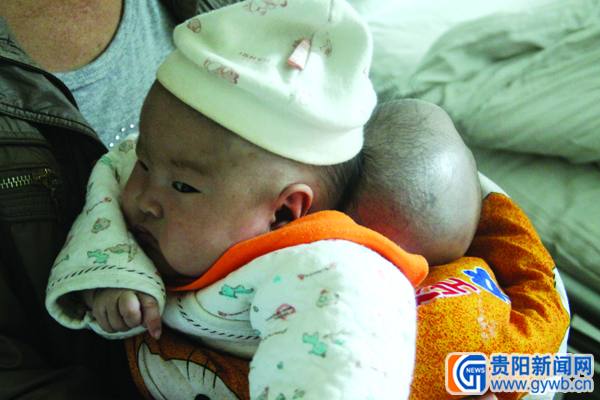 印江双头婴 娃娃一声哭泣 妈妈不忍放弃 (图)
