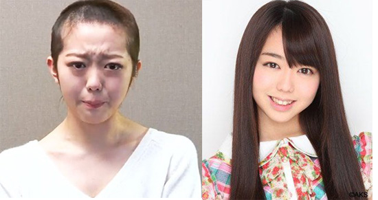 AKB __