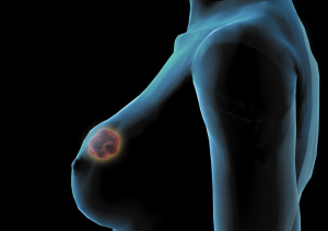 女人三十后每年做一次乳腺B超很重要