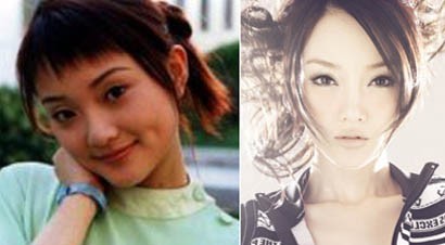 李小璐刘晓庆她们到底整了哪?权威整形专家来揭秘