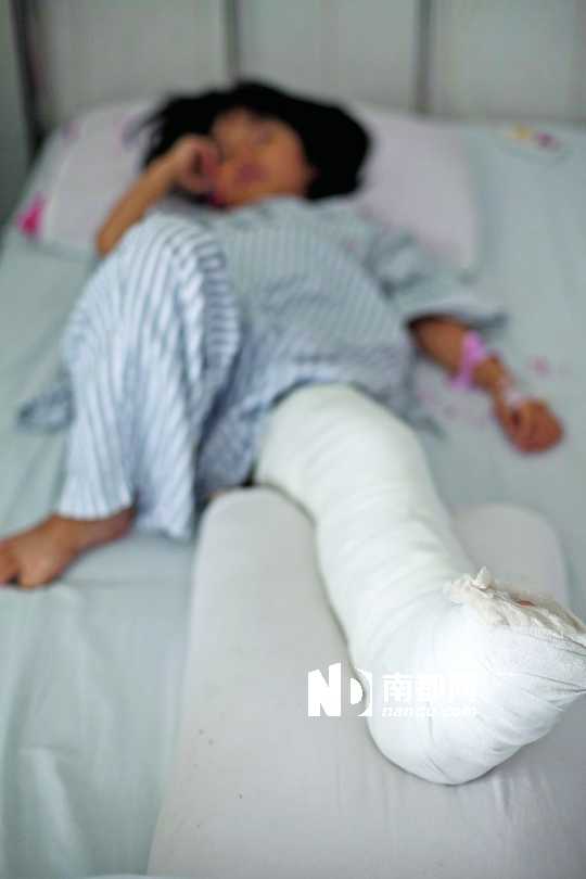 左小腿被撞骨折的7岁女童仍在医院接受医疗.