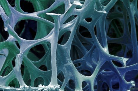 皮肤细胞变身骨细胞 美科学家发现断骨修复新