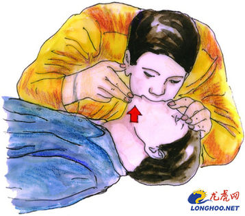 海姆立克急救法救醒噎晕小孩 儿童急救常识大