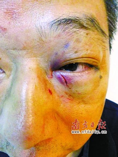 广州医生被死者家属打成脾脏破裂 家属发微博遭声讨