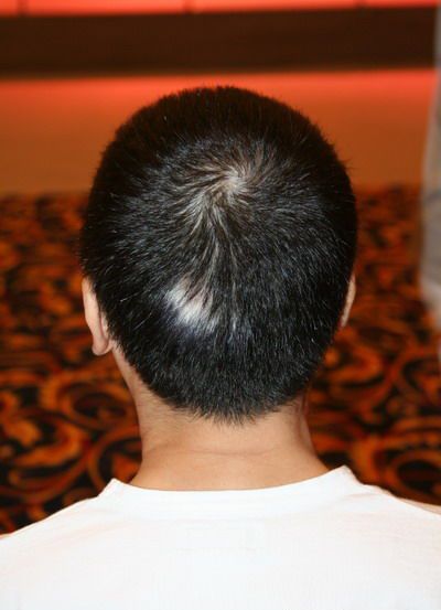 <em>后脑勺白发</em>_女生剃头发型剃<em>后脑勺</em>_男生<em>后脑</em>