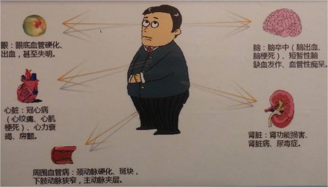 医提醒:高血压病人仅降压还不够!警惕靶器官损