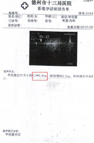 甲状腺报告单图片