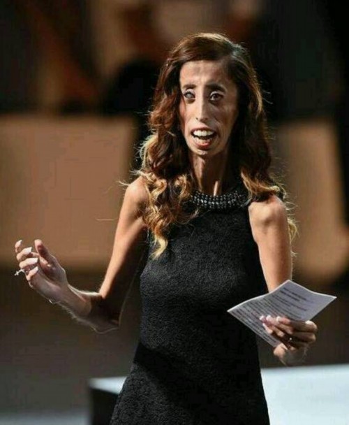 刘信达称愿娶世界最丑女人丽兹很美很性感图