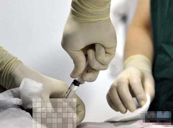 实拍人工受精全过程组图