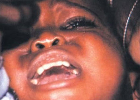 非洲女孩割礼图片