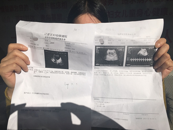 怀孕报告单图片一个月图片