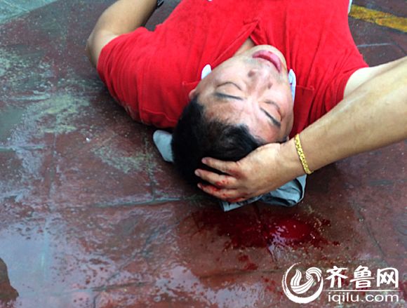 大厦业主辛罡被打倒在地,头破血流.图为大厦业主提供.
