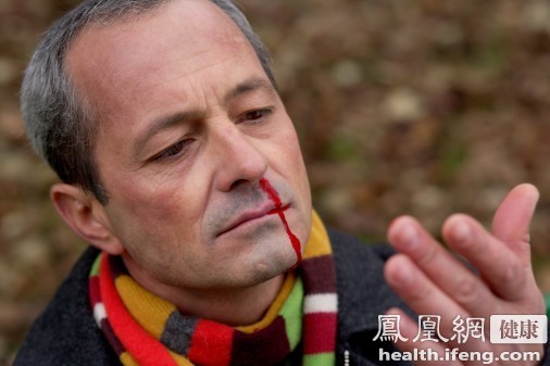 健康新知:鼻出血有哪些急救措施?