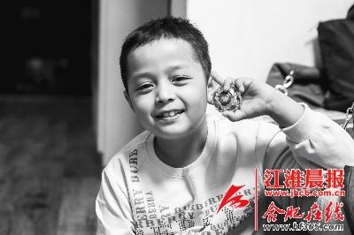 合肥:男孩生就一张欧美脸 医生分析或因基因突变