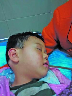 贵州:2岁男童被13厘米筷子插穿颈部 险穿出后脑