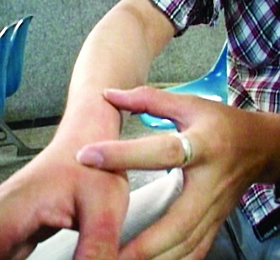 被砸男子手腕扭伤.